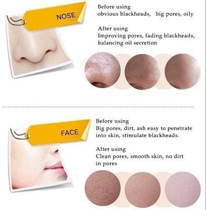 CHARCOAL MASK CREAM for Women | Helps in Removing Blackheads and Whiteheads, Deep Cleansing, Purifying Peel Off Mask Cream
